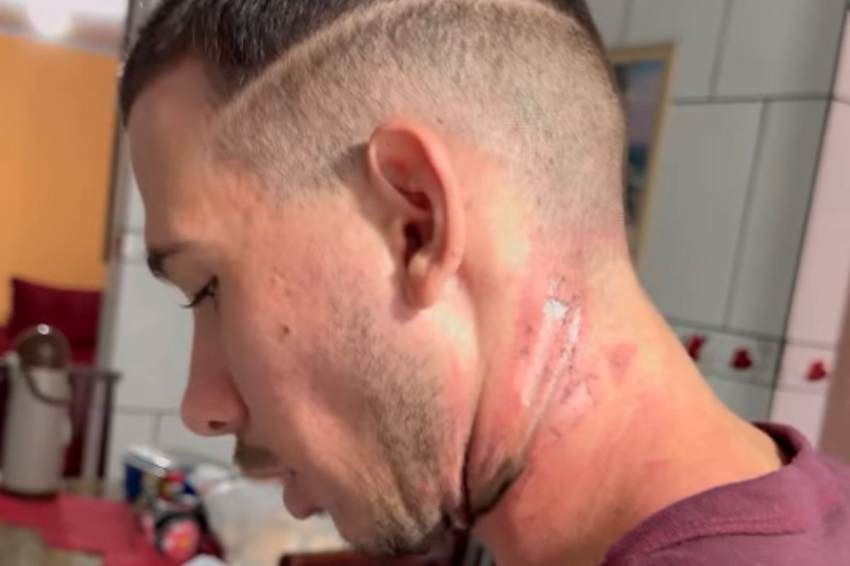 ‘Desesperador’: motociclista de SC relata momento em que foi arrastado por cabo solto na rua