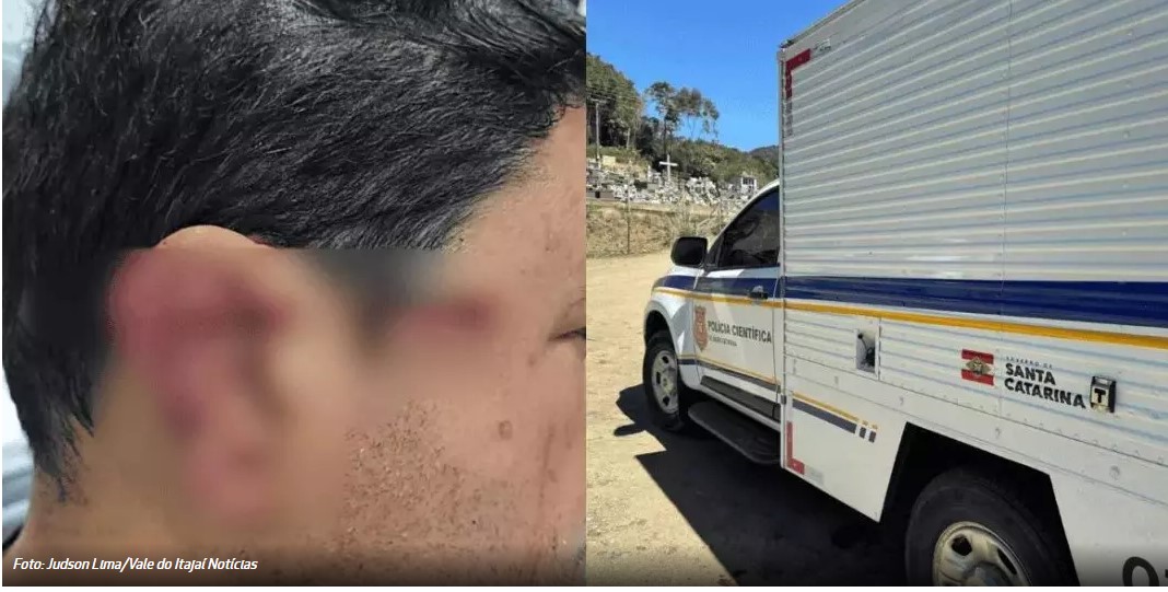 Assaltante acaba morto após balear empresário na cabeça em Indaial